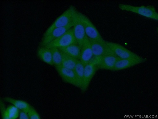 [15123-1-AP-20UL] NNMT Polyclonal antibody