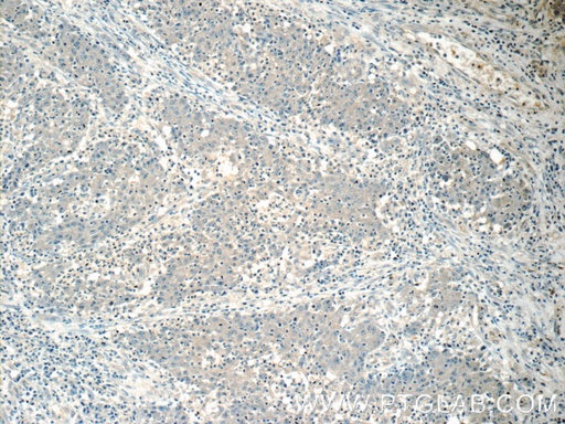 [15132-1-AP-20UL] HSCB Polyclonal antibody