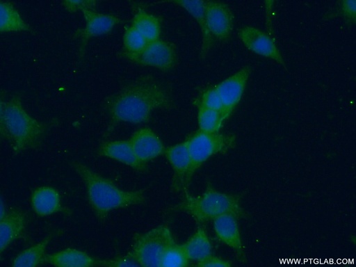 [15136-1-AP-150UL] NME3 Polyclonal antibody