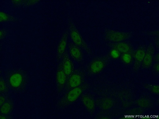 [15139-1-AP-150UL] GTF2F2 Polyclonal antibody