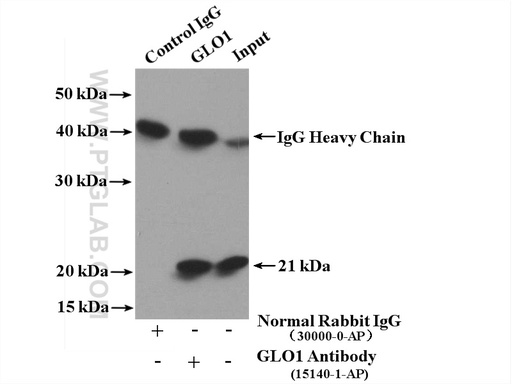 [15140-1-AP-150UL] GLO1 Polyclonal antibody