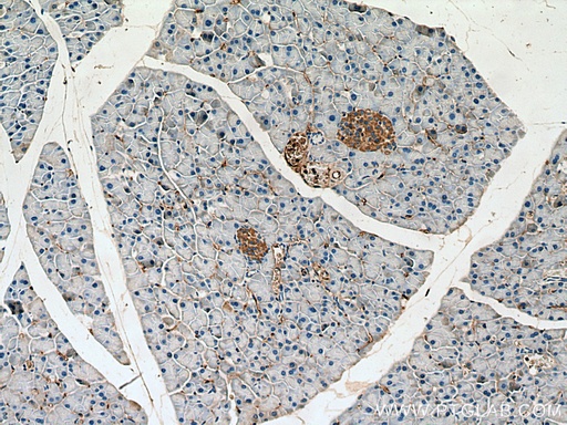 [15141-1-AP-150UL] INPP5B Polyclonal antibody