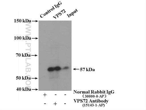 [15143-1-AP-150UL] VPS72 Polyclonal antibody