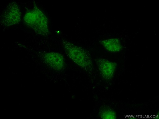 [15144-1-AP-20UL] PPIL1 Polyclonal antibody
