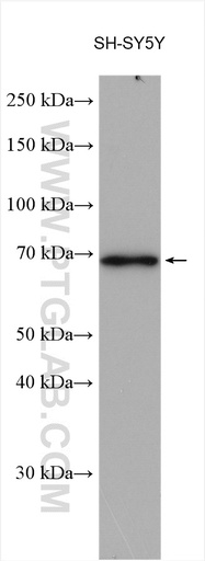 [15147-1-AP-150UL] CEP68 Polyclonal antibody