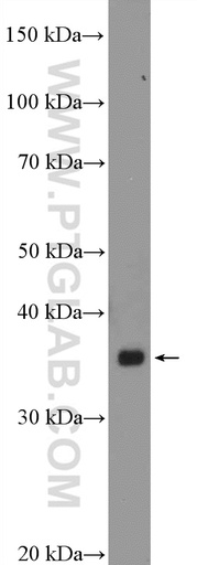 [15148-1-AP-150UL] BTN3A2 Polyclonal antibody