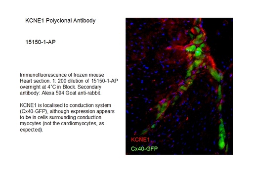 [15150-1-AP-150UL] KCNE1 Polyclonal antibody