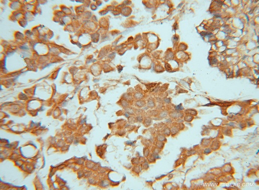 [15151-1-AP-20UL] PIGK Polyclonal antibody