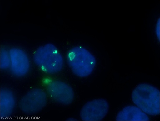 [15154-1-AP-20UL] PSMB2 Polyclonal antibody