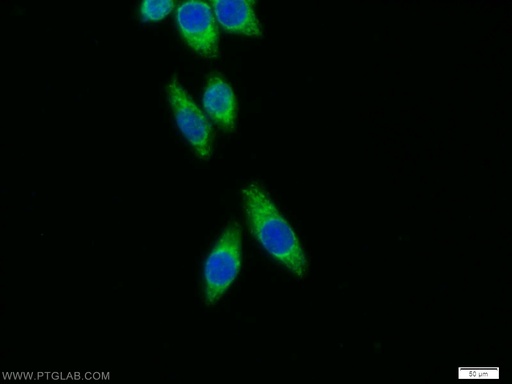 [15156-1-AP-150UL] SFXN3 Polyclonal antibody