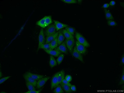 [15162-1-AP-150UL] SARS Polyclonal antibody