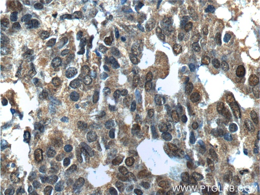 [15163-1-AP-20UL] NANS Polyclonal antibody