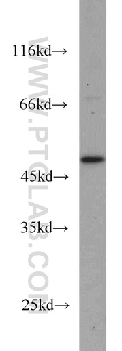 [15164-1-AP-20UL] GALK2 Polyclonal antibody