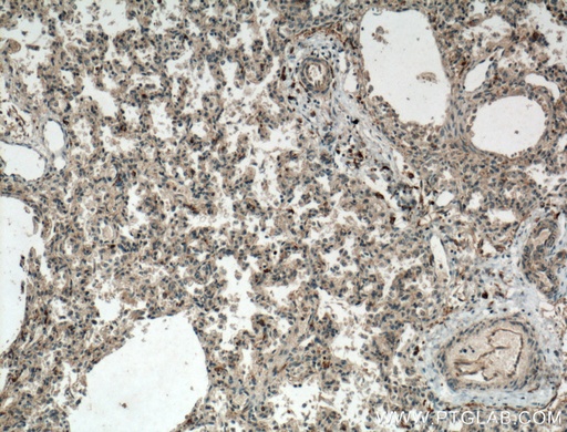 [15165-1-AP-150UL] WDR18 Polyclonal antibody