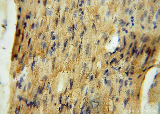 [15166-1-AP-20UL] MRPS34 Polyclonal antibody