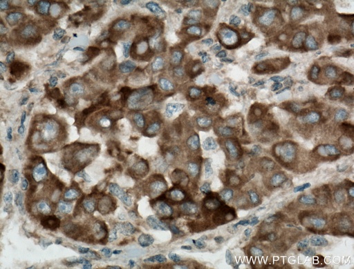 [15168-1-AP-150UL] SIGMAR1 Polyclonal antibody