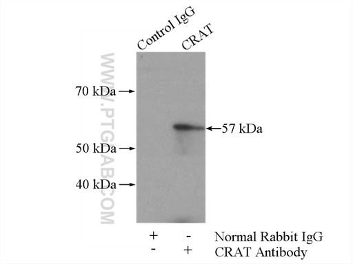 [15170-1-AP-150UL] CRAT Polyclonal antibody