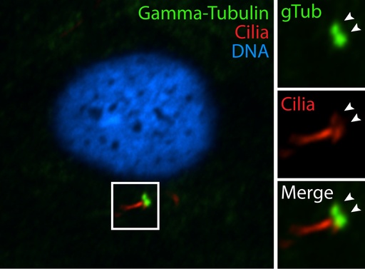 [15176-1-AP-20UL] Gamma Tubulin Polyclonal antibody