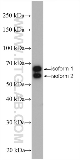 [15177-1-AP-150UL] Retrolinkin Polyclonal antibody