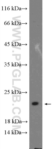[15178-1-AP-20UL] MRPL18 Polyclonal antibody
