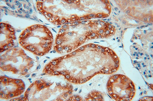 [15181-1-AP-20UL] NDUFAF1 Polyclonal antibody