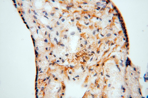 [15182-1-AP-150UL] NLRP2 Polyclonal antibody