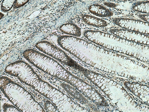 [15186-1-AP-150UL] PRL3 Polyclonal antibody
