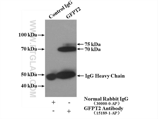 [15189-1-AP-150UL] GFPT2 Polyclonal antibody