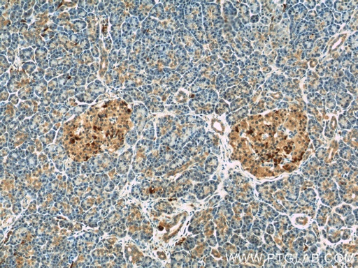 [15191-1-AP-20UL] COL4A3BP Polyclonal antibody