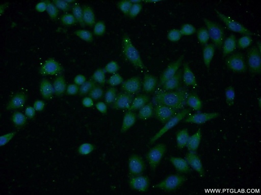 [15194-1-AP-150UL] DHFR Polyclonal antibody