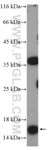 [15196-1-AP-20UL] MED10 Polyclonal antibody