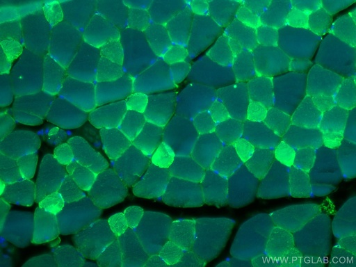 [15197-1-AP-150UL] CA3 Polyclonal antibody