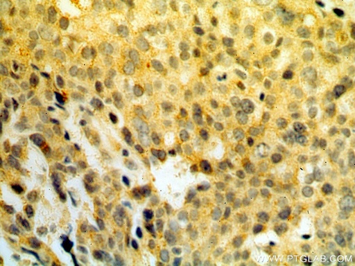 [15198-1-AP-20UL] RPS3 Polyclonal antibody