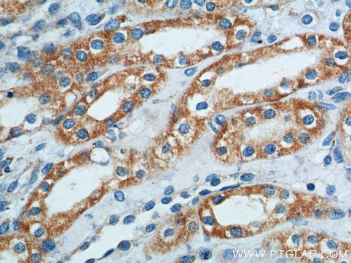 [15200-1-AP-20UL] B4GALT4 Polyclonal antibody