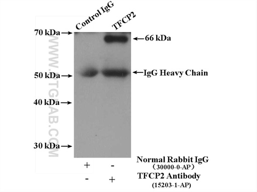 [15203-1-AP-150UL] TFCP2 Polyclonal antibody