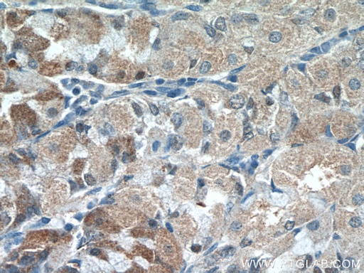 [15207-1-AP-20UL] CHAC1 Polyclonal antibody