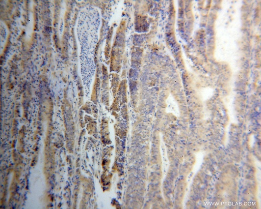 [15208-1-AP-150UL] THG1L Polyclonal antibody