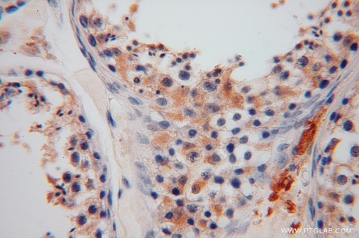 [15214-1-AP-150UL] GSTM3 Polyclonal antibody