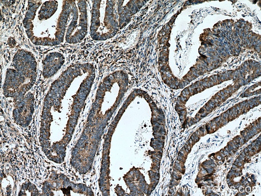 [15215-1-AP-20UL] CNPY3 Polyclonal antibody