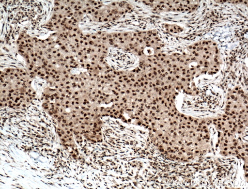 [15217-1-AP-150UL] RPB5 Polyclonal antibody
