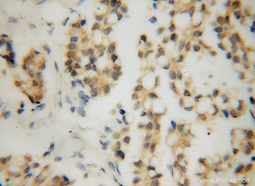 [15220-1-AP-20UL] RPAIN Polyclonal antibody