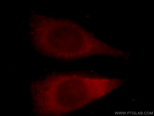 [15222-1-AP-20UL] YWHAH Polyclonal antibody