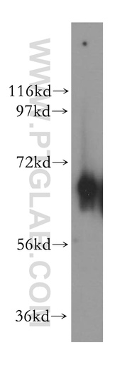 [15223-1-AP-20UL] NT5C2 Polyclonal antibody