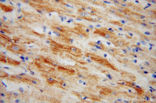 [15224-1-AP-150UL] NDUFS5 Polyclonal antibody