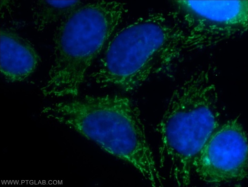 [15233-1-AP-20UL] MRPL34 Polyclonal antibody