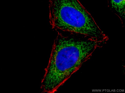 [15235-1-AP-20UL] SLC25A1 Polyclonal antibody