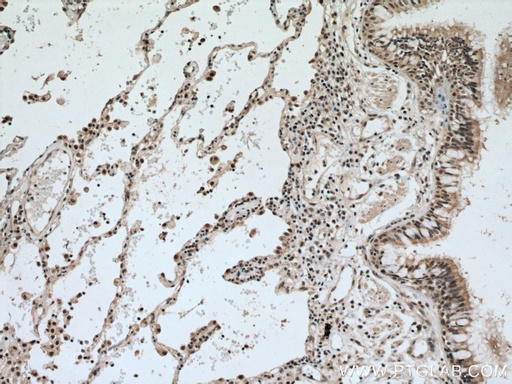 [15238-1-AP-20UL] MAEA Polyclonal antibody