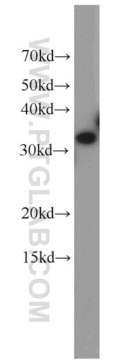 [15244-1-AP-150UL] ESD Polyclonal antibody