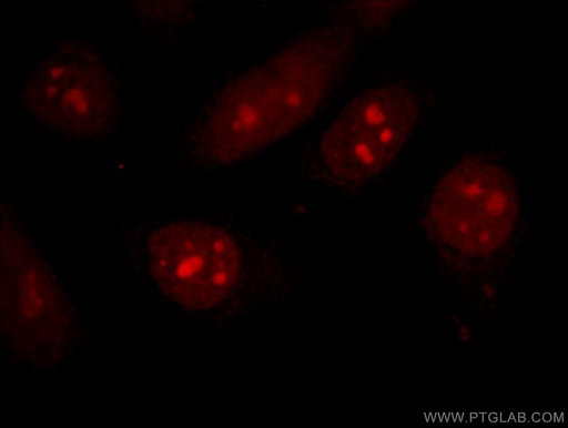 [15249-1-AP-20UL] CDCA7 Polyclonal antibody