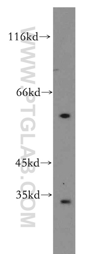 [15254-1-AP-150UL] GPR162 Polyclonal antibody